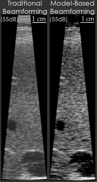 Traditional and Model-Based Beamforming