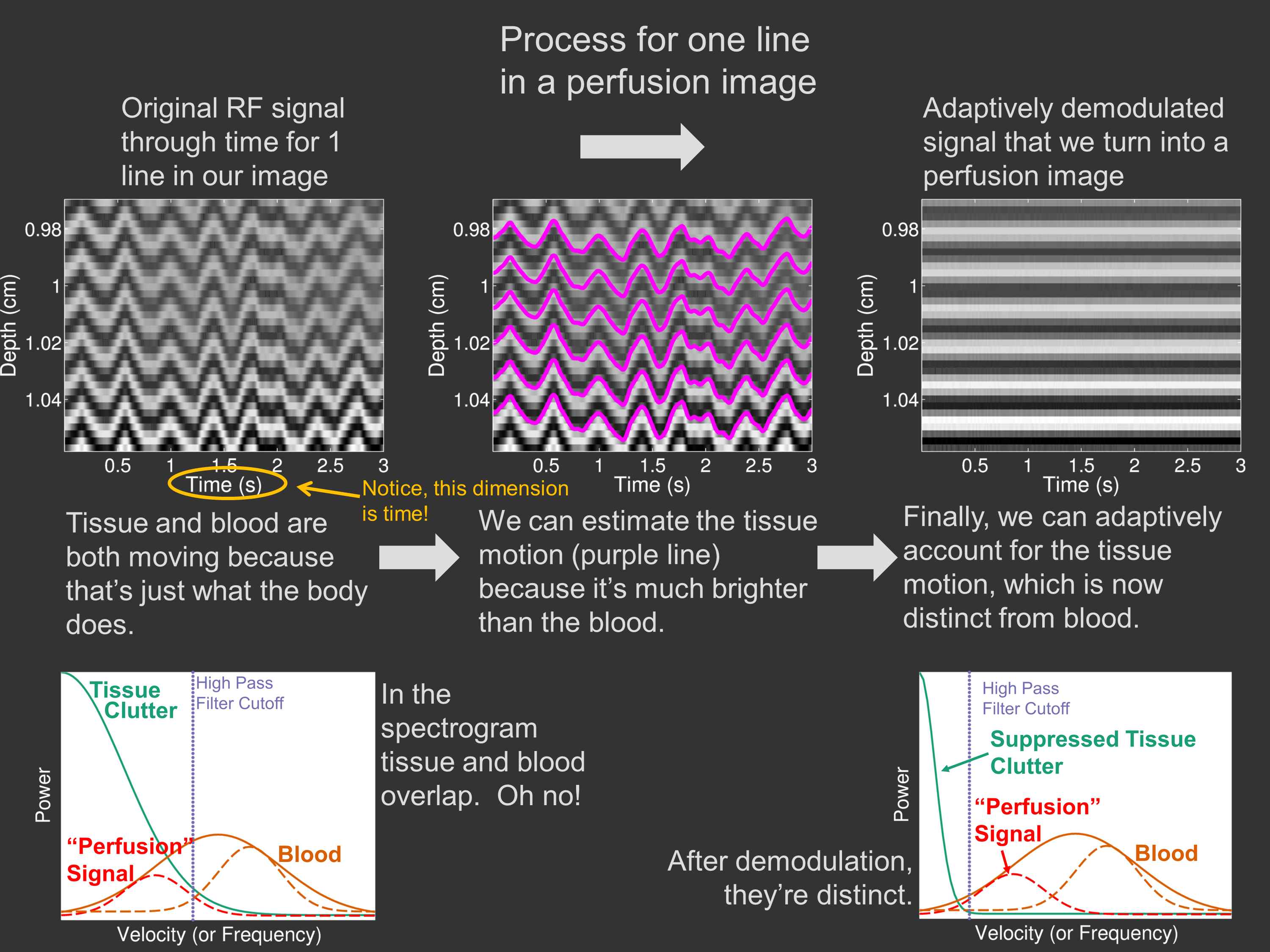 Perfusion Algorithm