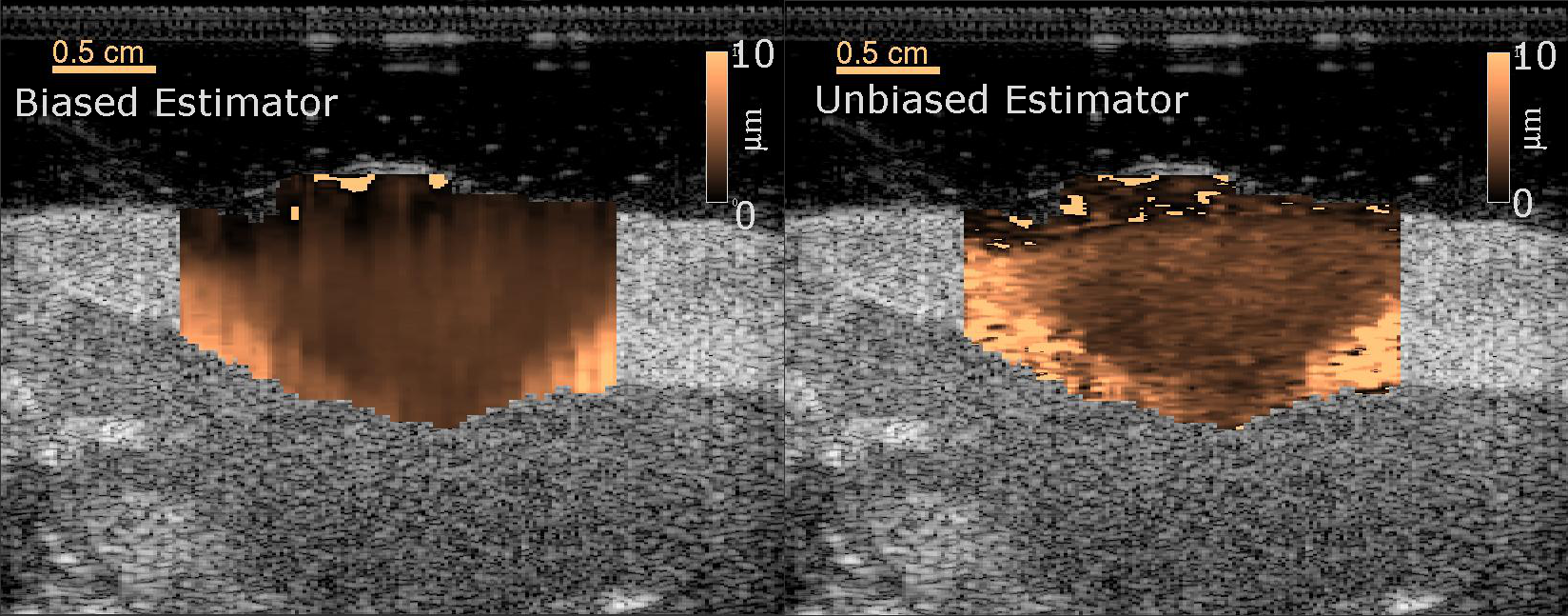 Biased and Unbiased ARFI images of a Lesion